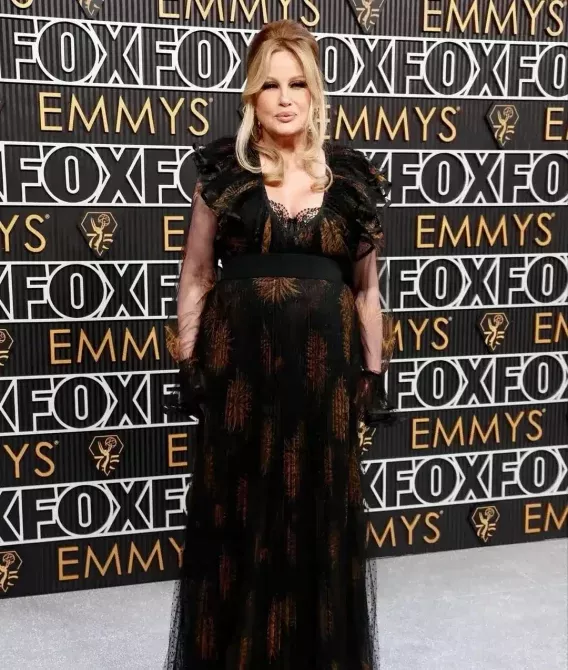 Surger plastyczny Jennifer Coolidge