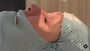  اس کے علاج کے ایک حصے میں ایک ماسک شامل ہے جو اس کے سر کو ساکت رکھتا ہے تاکہ لیزر ٹیومر کو گولی مار سکے۔