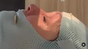  Ang bahagi ng kanyang paggamot ay may kasamang maskara na nagpapanatili sa kanyang ulo upang mabaril ng mga laser ang mga tumor